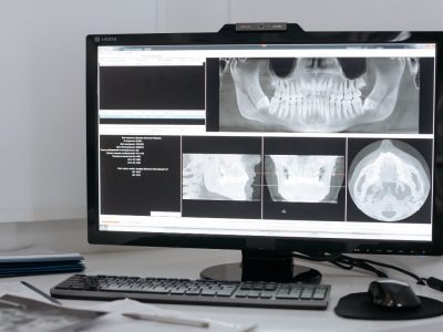 ouvrir un fichier DCM